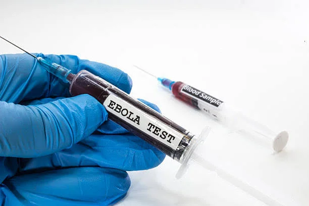 Doctor with syringe with blood infected with Ebola virus