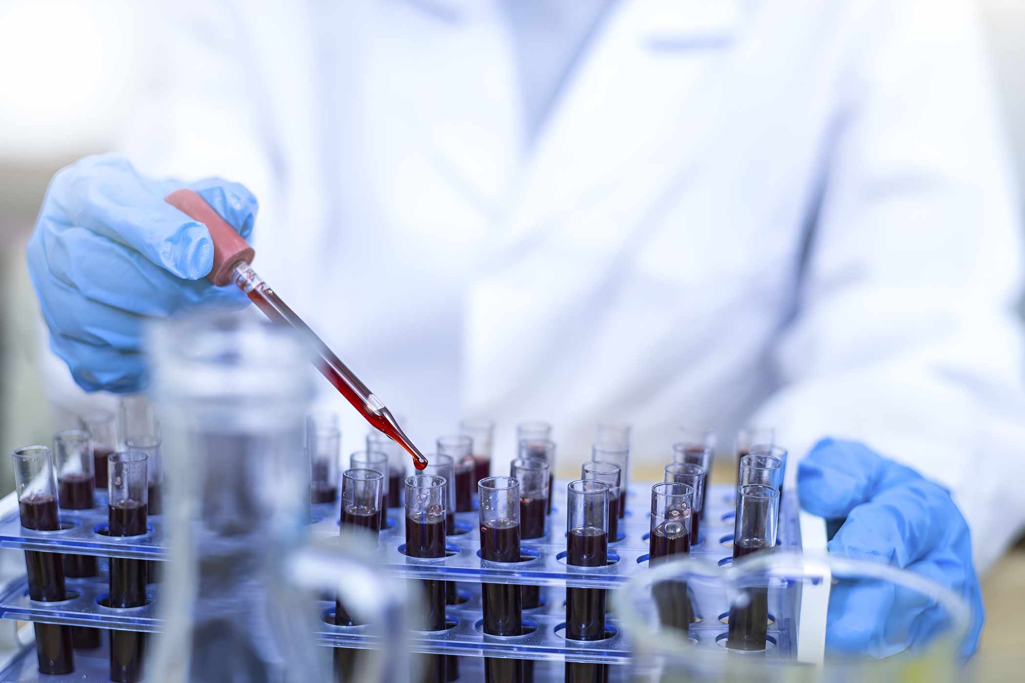 African scientists make breakthrough in breast cancer genetics