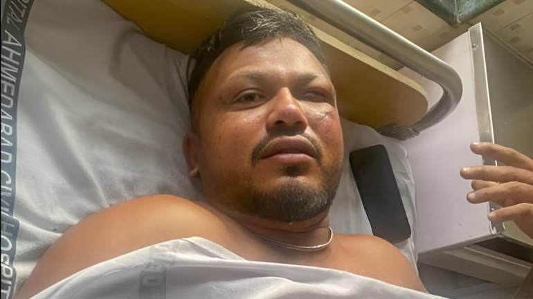 'Don't know I survived'- Lone survivor in Air India crash speaks
