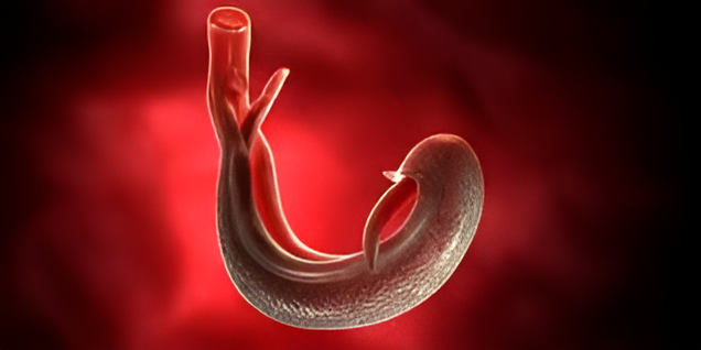 Spike in Bilharzia cases reported in Bungoma as sanitation woes persist