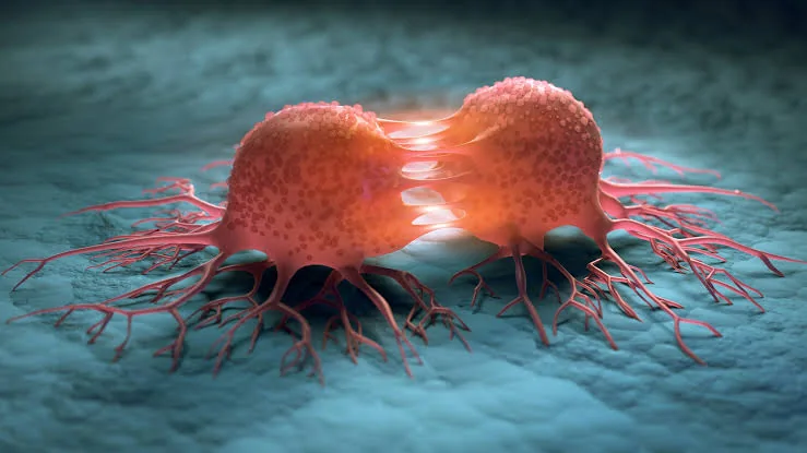 Cancer, stroke bills threaten to devour Kenyans’ retirement savings